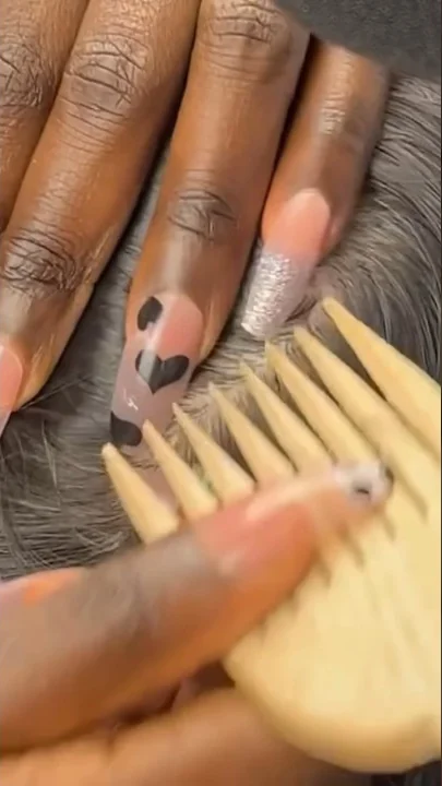 The Most satisfying NITPICKING Scalp WHITEHEADS  #youtubeshorts #shorts #asmr #satisfying